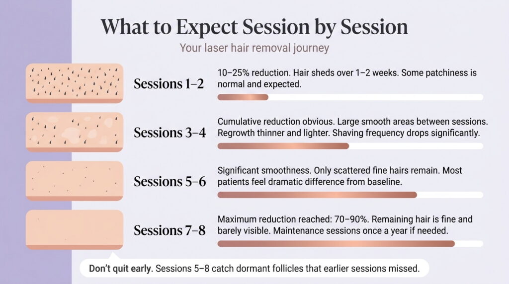 Laser hair removal session by session results